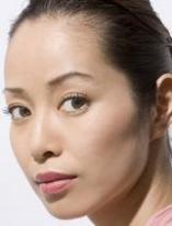 Eiko Nijo