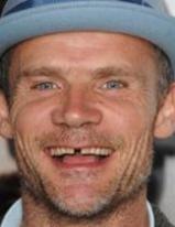  Flea