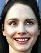 Laura Fraser